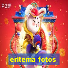 eritema fotos